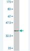 SRY-Box 21 antibody, H00011166-M02, Novus Biologicals, Western Blot image 