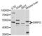 Signal Regulatory Protein Gamma antibody, abx003661, Abbexa, Western Blot image 