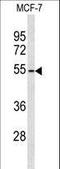 ADAM Like Decysin 1 antibody, LS-C156049, Lifespan Biosciences, Western Blot image 