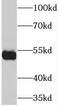 Nuclear Envelope Integral Membrane Protein 1 antibody, FNab08766, FineTest, Western Blot image 