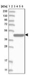 Interferon alpha-1 antibody, NBP2-38144, Novus Biologicals, Western Blot image 