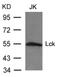 LCK Proto-Oncogene, Src Family Tyrosine Kinase antibody, 79-564, ProSci, Western Blot image 