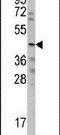 Cellular Communication Network Factor 6 antibody, PA5-13233, Invitrogen Antibodies, Western Blot image 