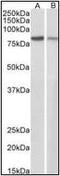 Junction Plakoglobin antibody, orb88033, Biorbyt, Western Blot image 