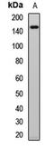 Ras Protein Specific Guanine Nucleotide Releasing Factor 1 antibody, LS-C668205, Lifespan Biosciences, Western Blot image 