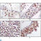 MAPK Activated Protein Kinase 5 antibody, LS-C812834, Lifespan Biosciences, Immunohistochemistry paraffin image 