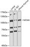 Minichromosome Maintenance Complex Component 4 antibody, GTX32717, GeneTex, Western Blot image 