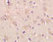 Opioid Receptor Kappa 1 antibody, orb10962, Biorbyt, Immunohistochemistry paraffin image 