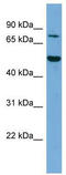 E74 Like ETS Transcription Factor 4 antibody, TA342333, Origene, Western Blot image 