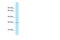 Caudal Type Homeobox 2 antibody, 27-354, ProSci, Western Blot image 