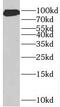 Prospero Homeobox 1 antibody, FNab06809, FineTest, Western Blot image 