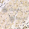 Transmembrane Serine Protease 2 antibody, A1979, ABclonal Technology, Immunohistochemistry paraffin image 