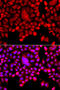 Tyrosyl-DNA Phosphodiesterase 1 antibody, STJ110291, St John