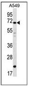 Deleted In Azoospermia 4 antibody, AP51188PU-N, Origene, Western Blot image 