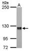 Amphiphysin antibody, LS-C185530, Lifespan Biosciences, Western Blot image 