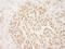 Protein Arginine Methyltransferase 6 antibody, NB110-40713, Novus Biologicals, Immunohistochemistry frozen image 