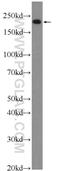 Myosin Heavy Chain 3 antibody, 22287-1-AP, Proteintech Group, Western Blot image 