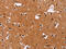 Chromobox 3 antibody, CSB-PA999326, Cusabio, Immunohistochemistry paraffin image 