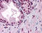 Androgen Receptor antibody, 51-393, ProSci, Immunohistochemistry paraffin image 