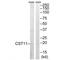 Cystatin 11 antibody, A14842, Boster Biological Technology, Western Blot image 