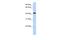 Transcriptional Adaptor 1 antibody, PA5-69843, Invitrogen Antibodies, Western Blot image 