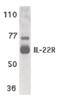 Interleukin 22 Receptor Subunit Alpha 1 antibody, PA5-19987, Invitrogen Antibodies, Western Blot image 