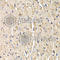 Secreted Frizzled Related Protein 2 antibody, A5383, ABclonal Technology, Immunohistochemistry paraffin image 