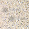 Secreted frizzled-related protein 2 antibody, A5383, ABclonal Technology, Immunohistochemistry paraffin image 