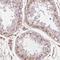 TBK1 Binding Protein 1 antibody, NBP2-38057, Novus Biologicals, Immunohistochemistry frozen image 