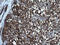 Fibrinogen Gamma Chain antibody, M00790, Boster Biological Technology, Immunohistochemistry paraffin image 