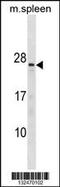 Troponin C2, Fast Skeletal Type antibody, 60-615, ProSci, Western Blot image 