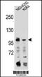 Transferrin Receptor 2 antibody, 56-432, ProSci, Western Blot image 