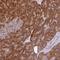 Ribosomal Protein L28 antibody, NBP2-13254, Novus Biologicals, Immunohistochemistry paraffin image 