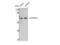 Cytochrome P450 Family 4 Subfamily F Member 2 antibody, STJ92600, St John