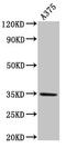 Melanocortin 1 Receptor antibody, LS-C670652, Lifespan Biosciences, Western Blot image 
