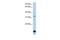 Beta-1,3-Galactosyltransferase 6 antibody, GTX45883, GeneTex, Western Blot image 