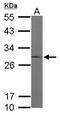 Endoplasmic Reticulum Protein 29 antibody, NBP1-33076, Novus Biologicals, Western Blot image 