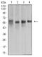 Keratin 10 antibody, NBP2-61737, Novus Biologicals, Western Blot image 