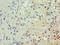 JunB Proto-Oncogene, AP-1 Transcription Factor Subunit antibody, LS-C375997, Lifespan Biosciences, Immunohistochemistry paraffin image 