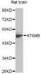 Autophagy Related 4B Cysteine Peptidase antibody, LS-C749125, Lifespan Biosciences, Western Blot image 