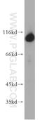 Hexokinase 1 antibody, 19662-1-AP, Proteintech Group, Western Blot image 