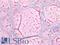 Thyroglobulin antibody, LS-B3172, Lifespan Biosciences, Immunohistochemistry paraffin image 