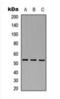 Mitogen-Activated Protein Kinase Kinase Kinase 8 antibody, orb393100, Biorbyt, Western Blot image 
