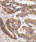 Protein Kinase C Zeta antibody, abx033125, Abbexa, Western Blot image 