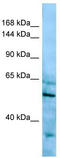 Hydroxymethylglutaryl-CoA synthase, cytoplasmic antibody, TA346706, Origene, Western Blot image 
