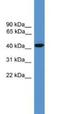 Synaptotagmin 9 antibody, NBP1-69104, Novus Biologicals, Western Blot image 