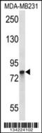 Peptidyl Arginine Deiminase 2 antibody, 57-682, ProSci, Western Blot image 