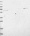 Target Of Myb1 Like 2 Membrane Trafficking Protein antibody, NBP1-86414, Novus Biologicals, Western Blot image 