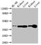 Adenosine Kinase antibody, orb400984, Biorbyt, Western Blot image 