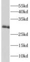 Interleukin 22 Receptor Subunit Alpha 2 antibody, FNab04254, FineTest, Western Blot image 